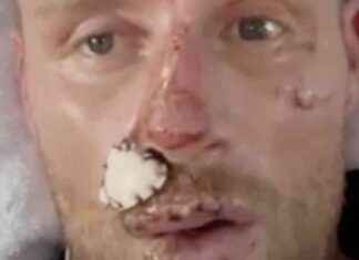 Freddie Flintoff Shares Emotional Journey of Injuries in New Video news-14082024-032300