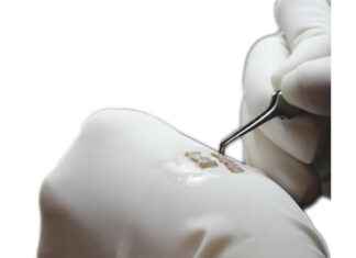 Transform Your Look: The Ultimate Guide to Hair Transplantation in Antalya