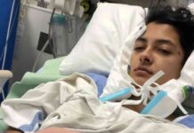 snapped-jaw-from-gobstopper-sweet-hospitalization-and-recovery